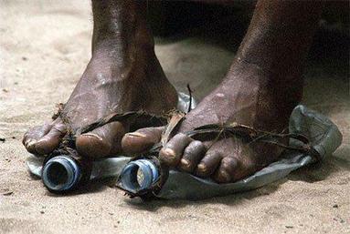 Poor Feet1 Poor Feet1